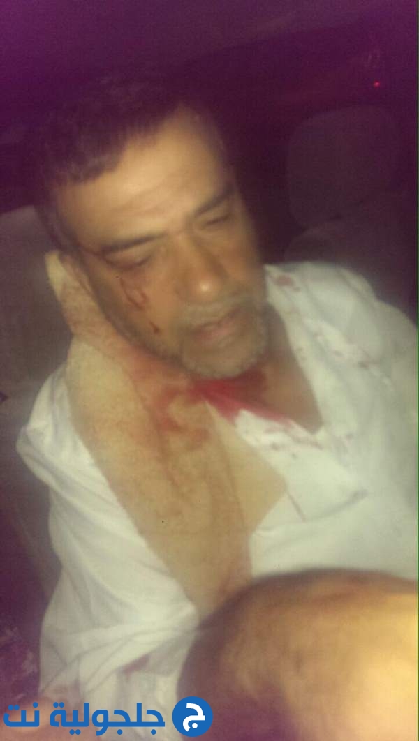 اعتداء على المواطن عماد أبو شرخ من اللد من قبل مستوطنون 